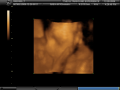 Photo Preview