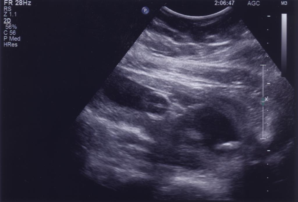 September 28th Ultrasound pic 4 of 4